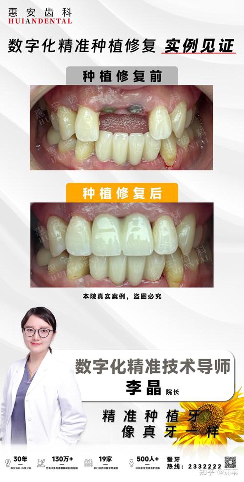 牙齿矫正：选择指南
