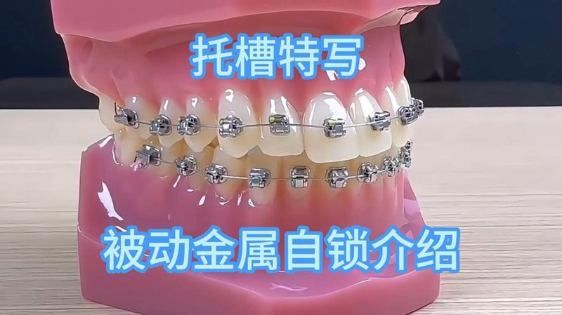 补牙